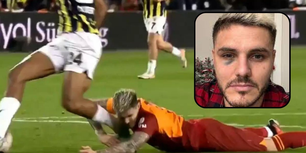 Icardi'nin 'göz' paylaşımına "ceza" engeli