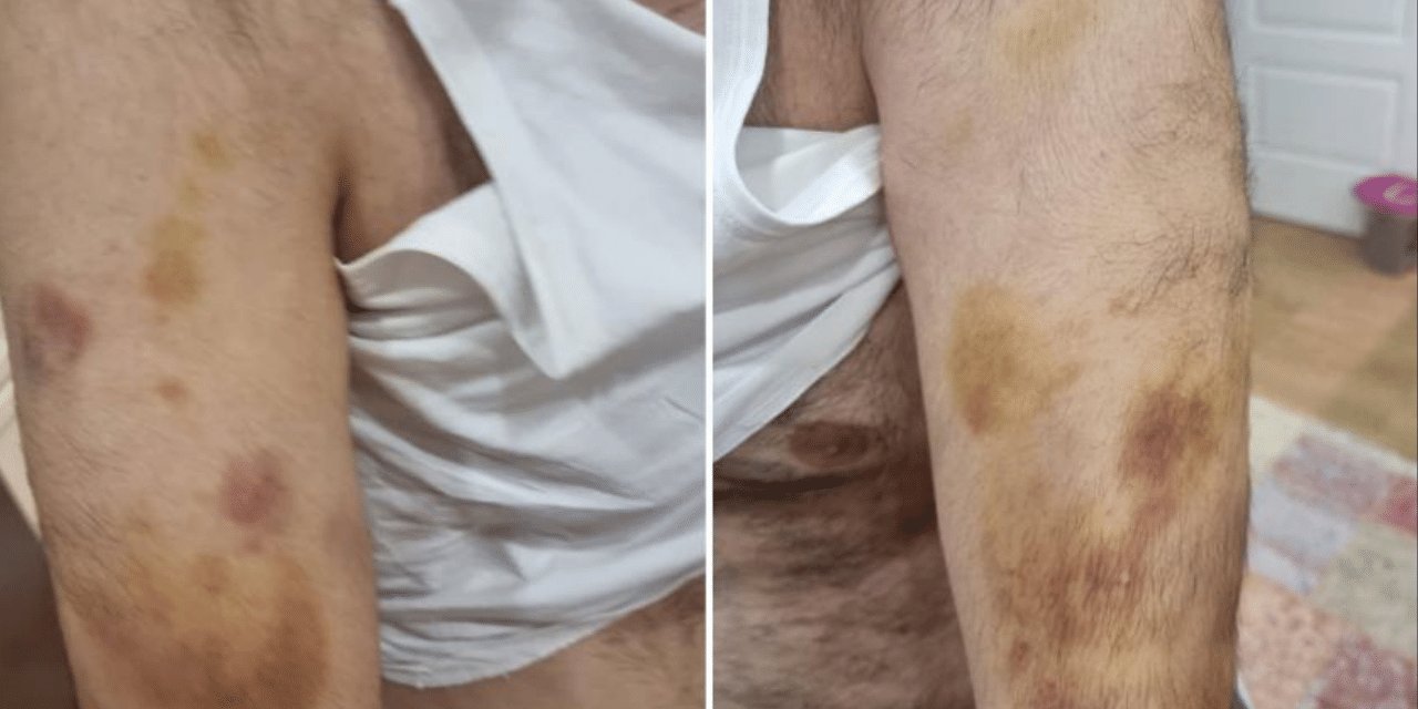 Büyükçekmece'de, otizmli öğrenciyi darbettiği iddia edilen öğretmen tutuklandı