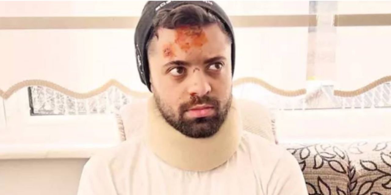 Eylem Tok'un oğlunun karıştığı kazada tanık konuştu: Biri telefonumu elimden aldı