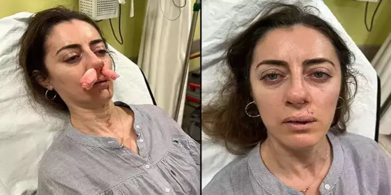 Yanlışlıkla 'yasak aşk' mağduru oldu: Eşinin sevgilisi zanneden kadın tarafından kabusu yaşamıştı! ‘Otomobil kapısı’ silah sayıldı