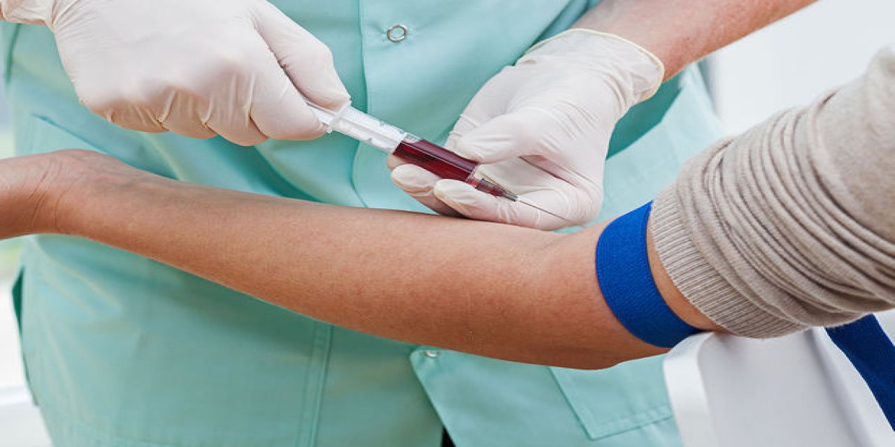 Yeni bir kan testi geliştirildi: Koronavirüse yakalandıysan yoğun bakım ve ölme ihtimalini tesbit ediyor