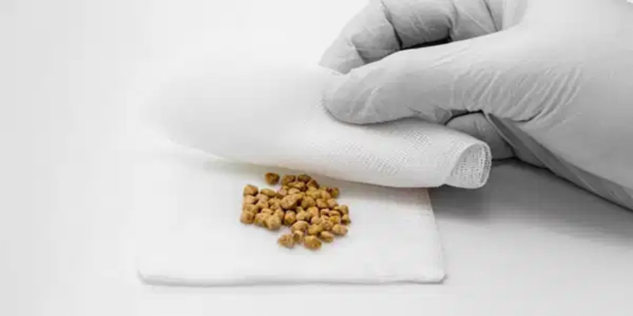 Belirtiler mide ağrısıyla karıştırılıyor: Safra taşlarına dikkat!