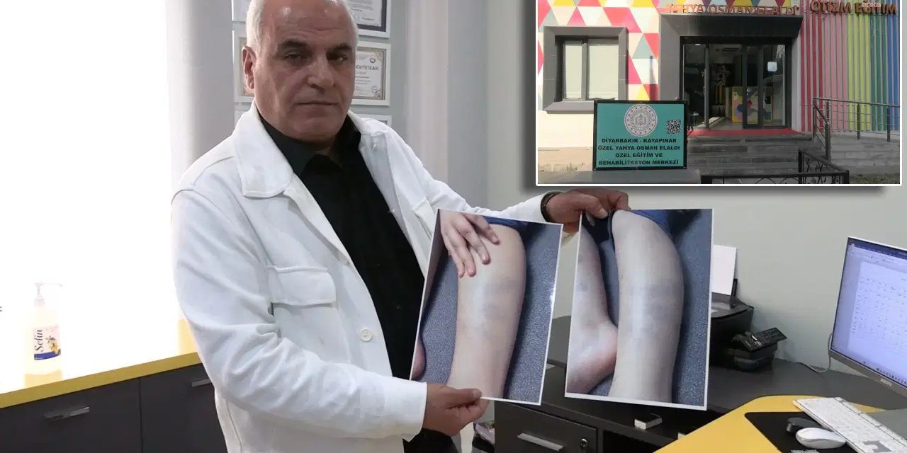 Torunu okulda şiddet gördü: Mağdur çocuklara destek birimi kurdu