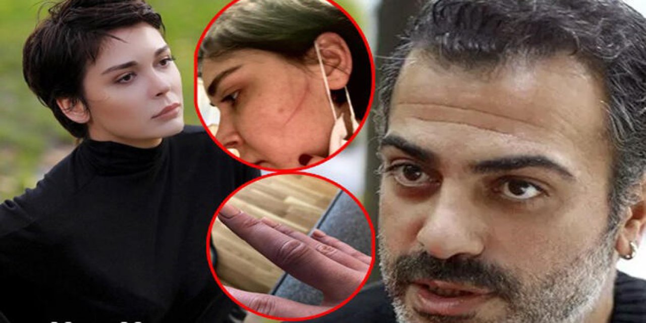 Sular durulmuyor: "Sunamadıklarınız bende var" demişti...  Sevcan Yaşar'dan bomba iddia! "Sermiyan Midyat dövüp çıplak videomu çekti!"