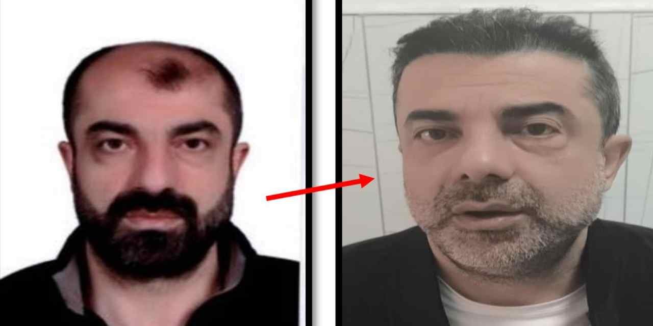 Cinayet zanlısı ameliyatla yüzünü değiştirip saklandı: 7 yıl sonra yakalandı