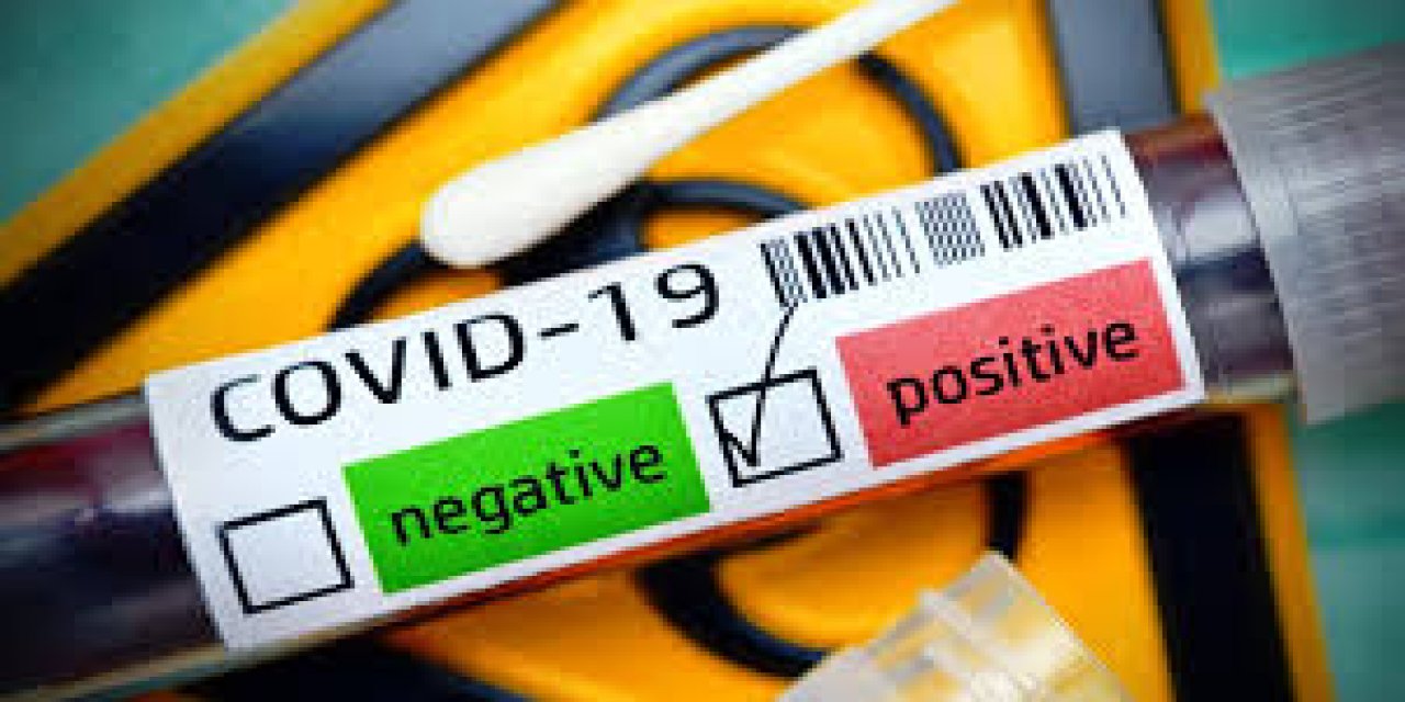 "İyileşen hasta sayısı" krizi büyüyor... Tablodaki mucizevi değişim nasıl oldu?