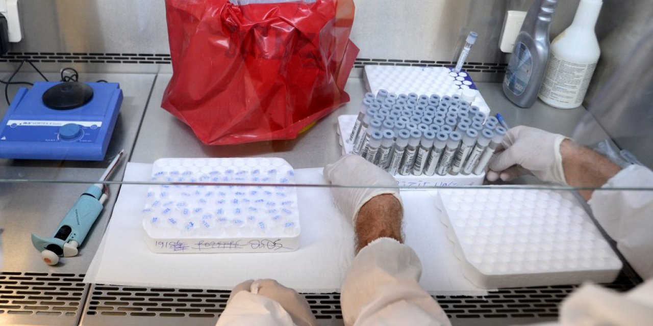 Bu laboratuvarda koronavirüs testi sonuçlarının kesinlik oranı yüzde 100