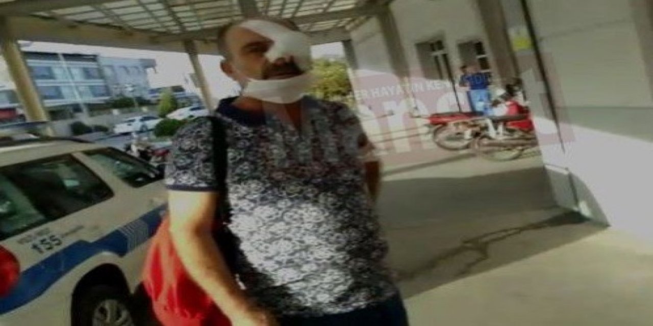 Ülkü Ocakları mensubu oldukları iddia edilen bir grup, sokak ortasında Cengiz Koraltan'ı darbetti