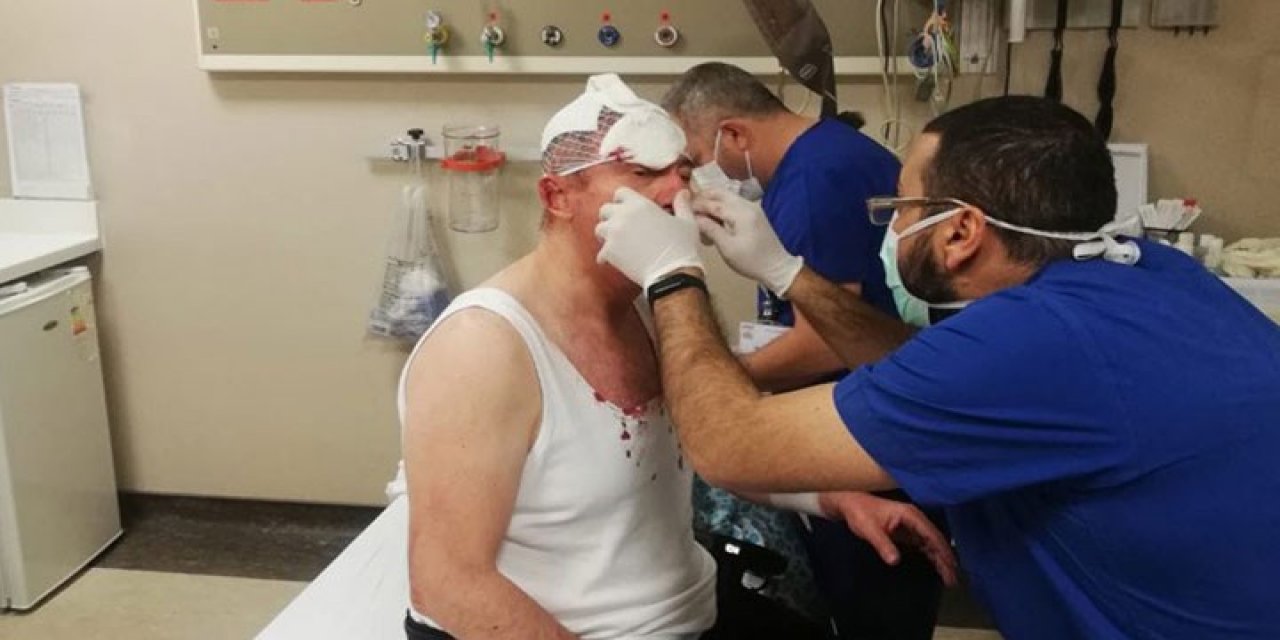 Gazeteci Uğuroğlu'na saldırıda 4 kişi serbest