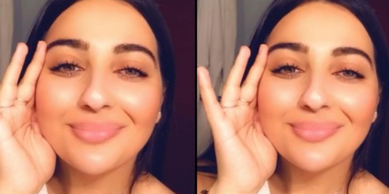 Estetik için geldiği hastaneden tabutla çıktı! Manolya'dan acı haber...