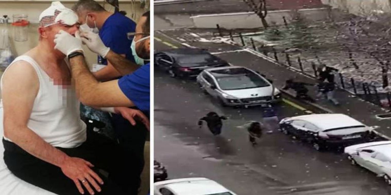 Selçuk Özdağ’a saldıranların ifadeleri ortaya çıktı! Özdağ’dan davacı ve şikayetçi olmuş...