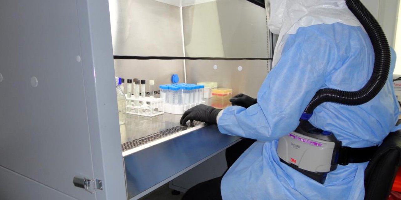 AÜ'den tüberkülozun erken teşhisinde önemli buluş