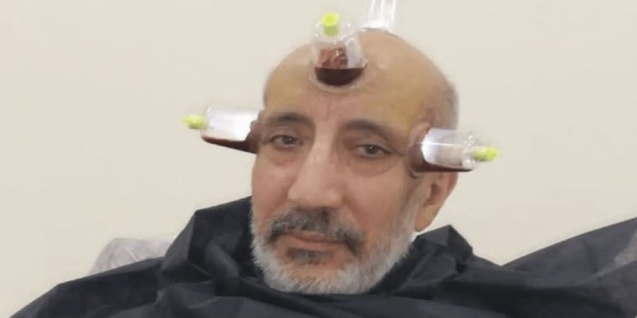 "Rahatsız olduğumdan değil" dedi ama... Abdurrahman Dilipak bu fotoğraf hakkında konuştu!