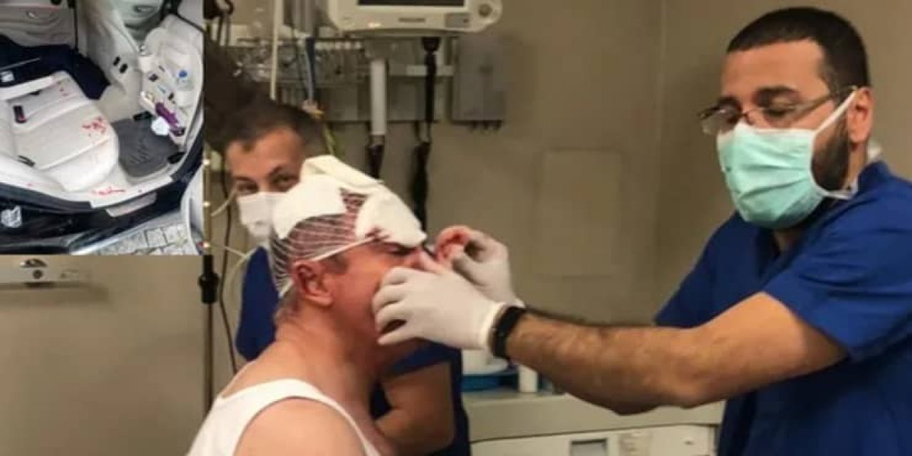 Selçuk Özdağ'a saldırıyla ilgili yeni gelişme