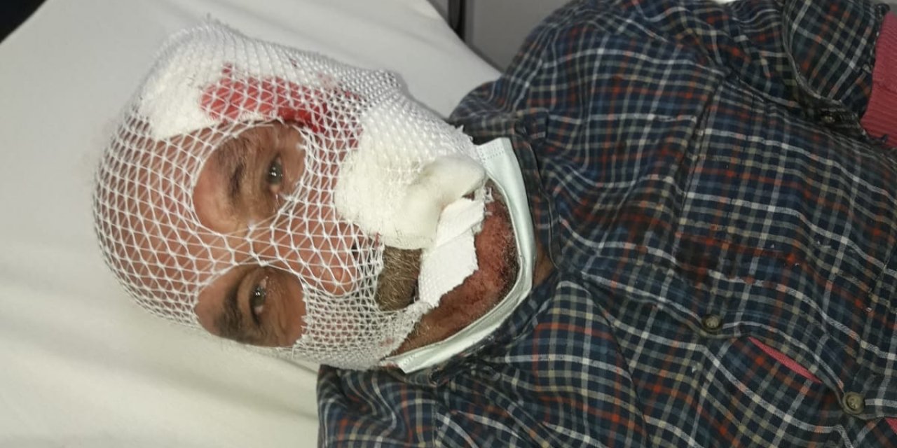Çocuklarını köpek saldırısından kurtardı, kendi yaralandı: Mahalle halkı tarafından kurtarılan Eke, hastanede tedaviye alındı.