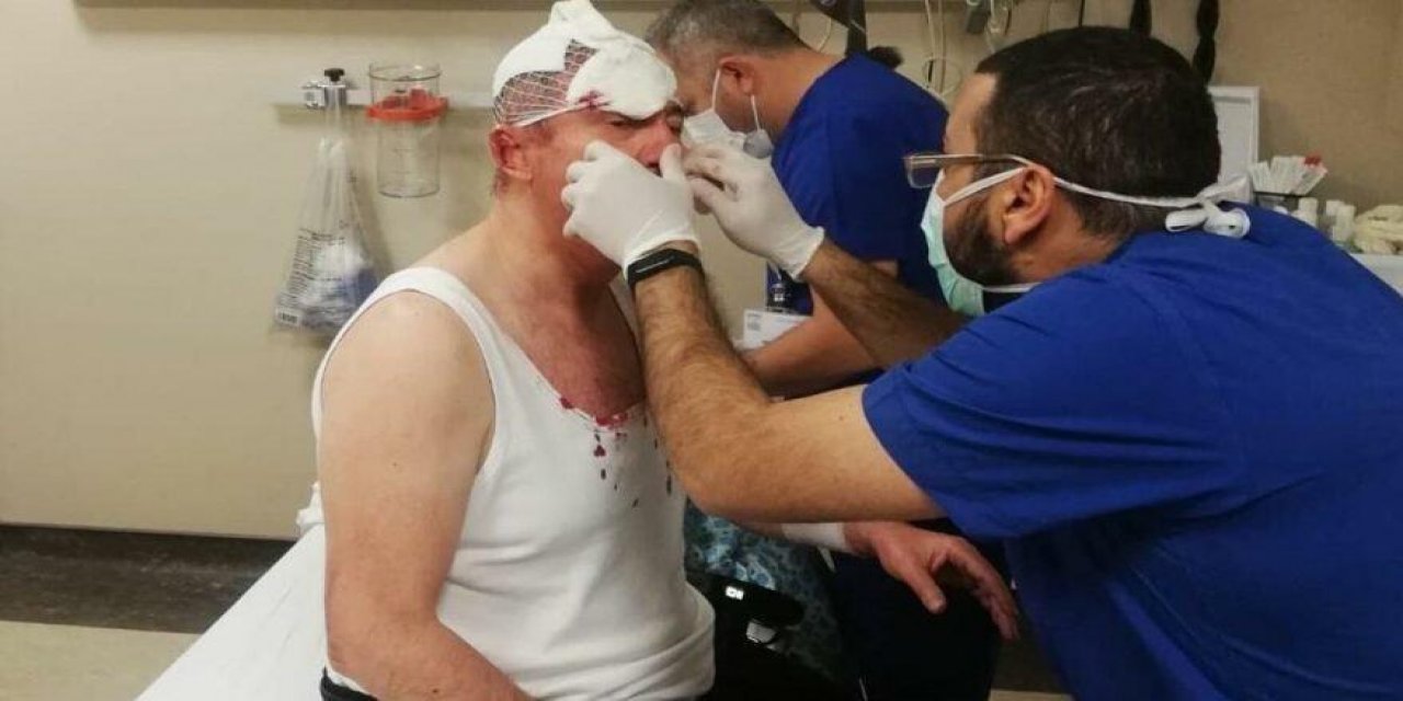 İddianame hazırlandı! İşte Selçuk Özdağ’a saldıranlar hakkında istenen ceza!