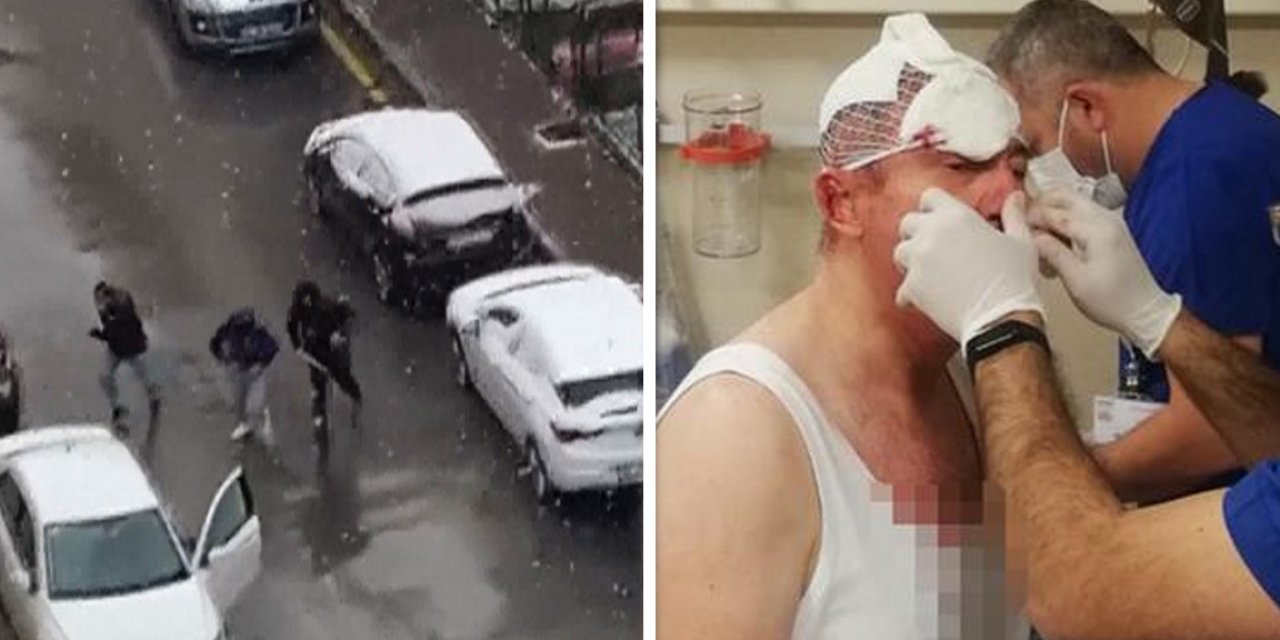 Selçuk Özdağ'a yönelik saldırı soruşturması tamamlandı! İşte saldırganlar için istenen ceza...