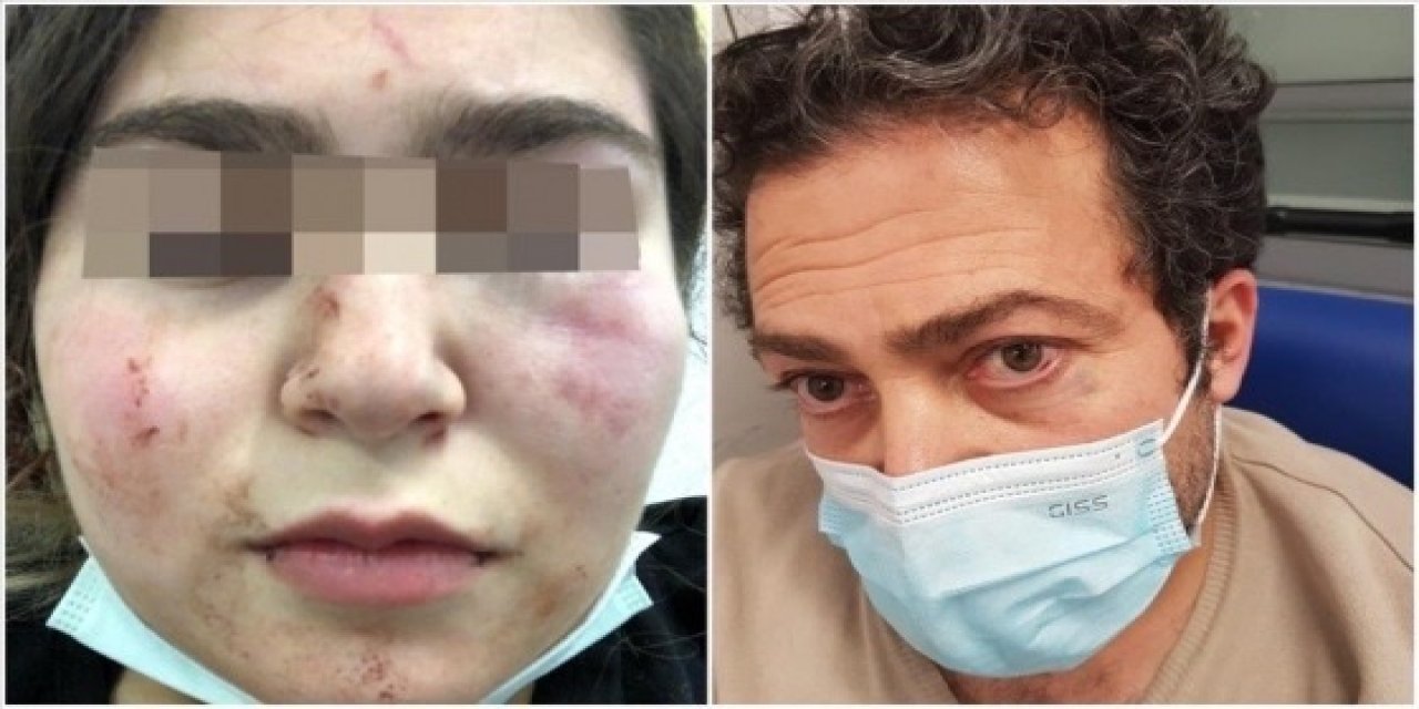 Almanya’da polisin kızıyla birlikte dövdüğü Türk konuştu