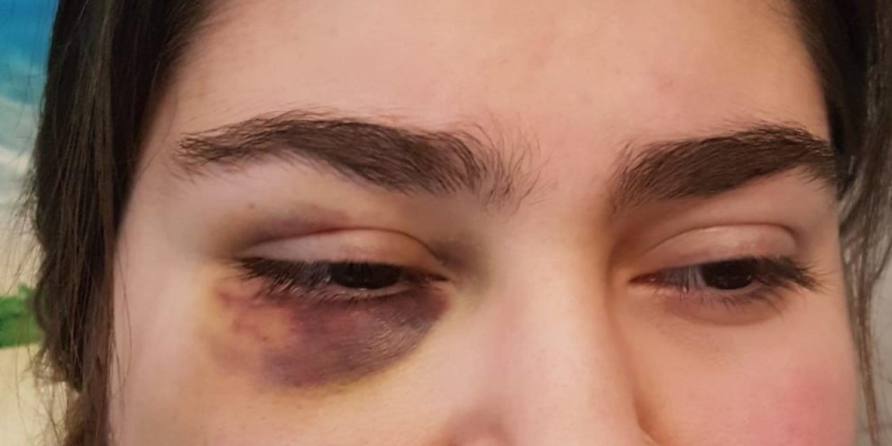 Almanya’da polisin kızıyla birlikte dövdüğü Türk konuştu