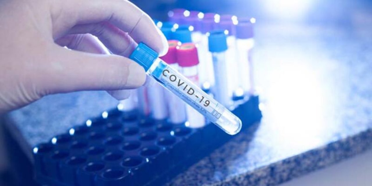 Doç. Dr. Obakan Yerlikaya: Koronavirüs varyantları daha bulaşıcı