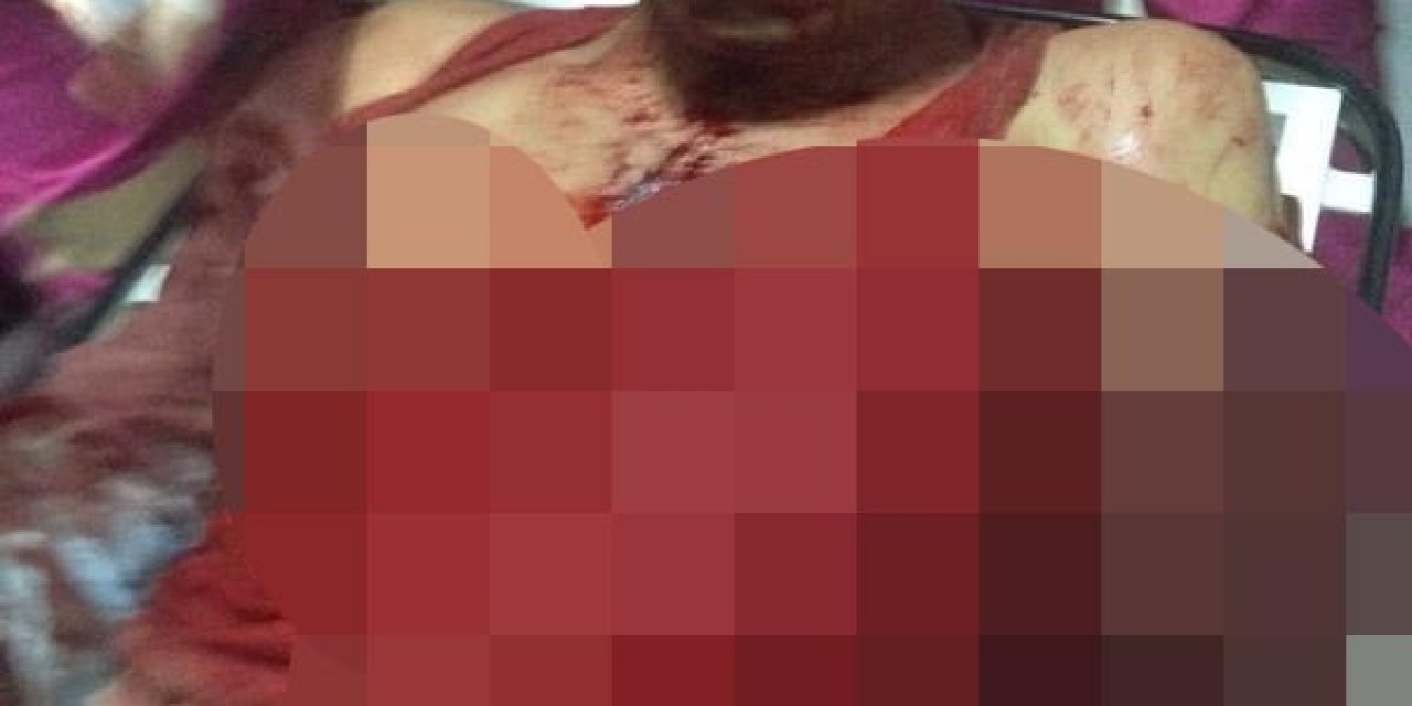 Yasin Börü ve arkadaşlarının öldürüldüğü olaydan yaralı kurtulan Yusuf Er yaşadıklarını anlattı