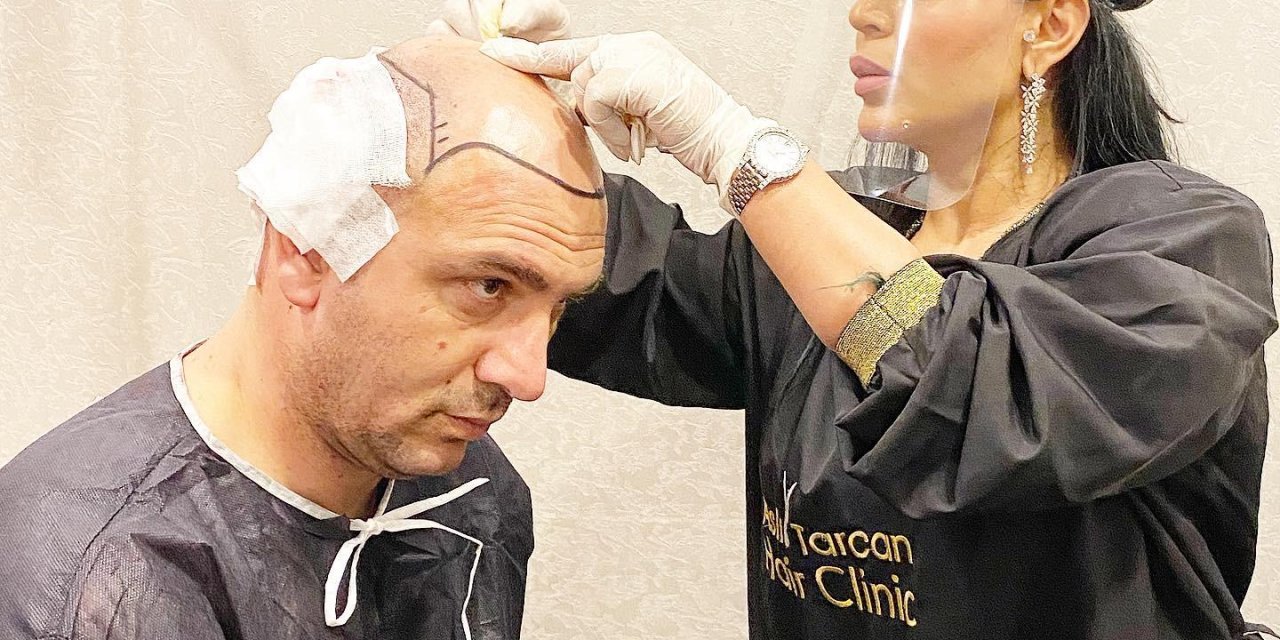 Pandemide de yabancıların saç ekimi için tercihi Türkiye