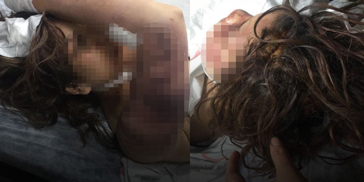 Kan donduran vahşet! Zincirle dövüp, tırnaklarını çekmiş...