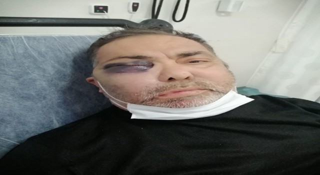 Yüzde 90 engelli vatandaşa darp etmişlerdi... O saldırganlar hakkında gelişme!