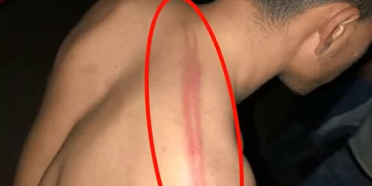 Yunan askerlerinin ölüme terk ettiği göçmenleri, Mehmetçik kurtardı