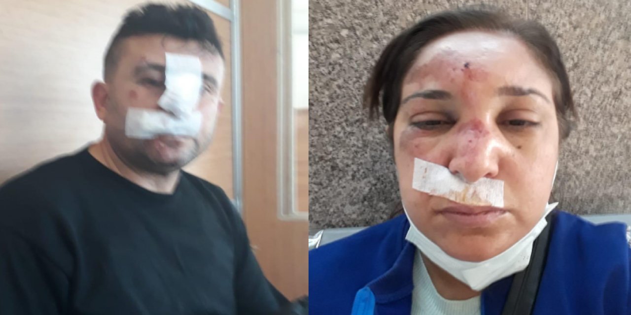 "Polis şiddeti hız kesmiyor!" Barış Yarkadaş sosyal medya hesabından duyurdu!  "Aracımızın önünü kesip dövdüler"