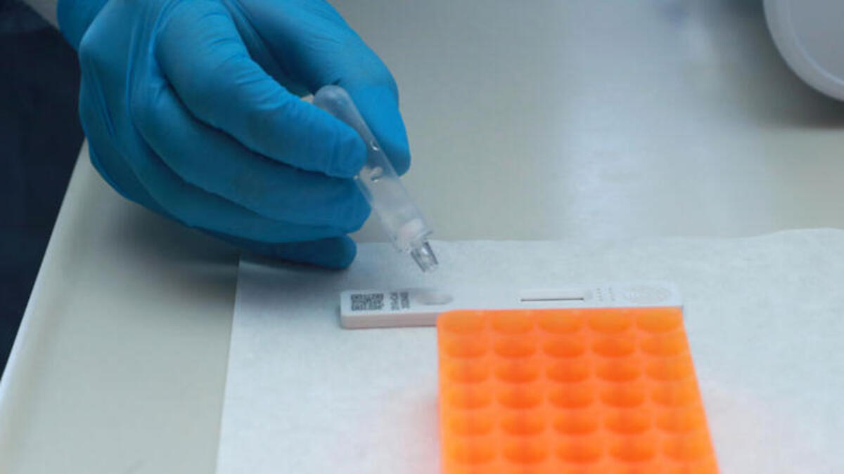 Yurttaşlar kendi yapabiliyor... Bu koronavirüs testi yok satıyor!