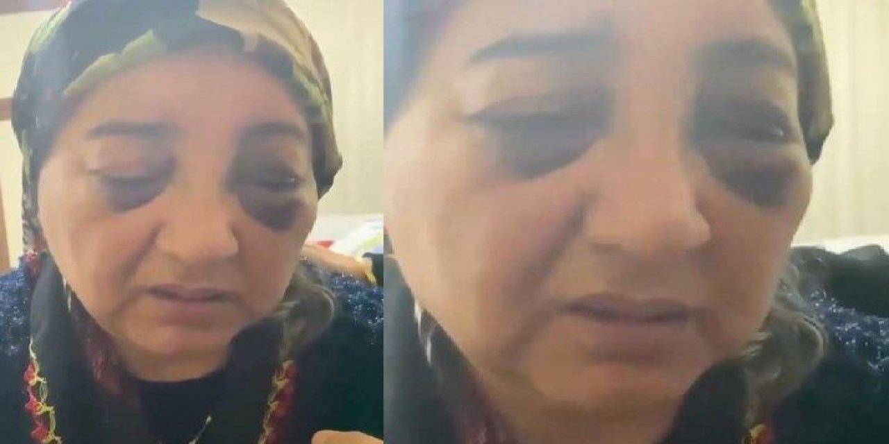 Bir koca vahşeti daha...  2 gün boyunca dövüp aç bıraktı!