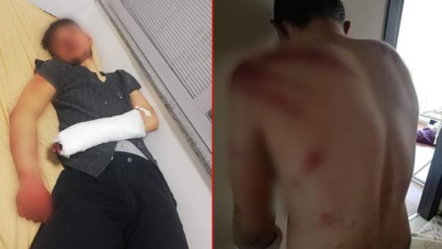 Hakkı olan parayı istediği için saatlerce işkence görmüştü... 16 yaşındaki çocuğun vahşice darp edildiği olayda yeni gelişme!