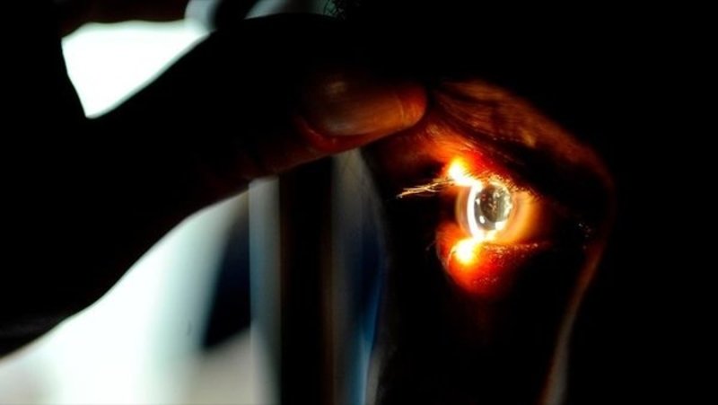 Bu hastalık ciddiye alınmazsa körlüğe yol açabilir!