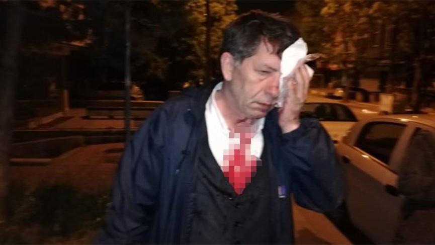 Gazeteci Yavuz Selim Demirağ saldırıya uğramıştı... Başsavcılıktan olaya ilişkin açıklama!