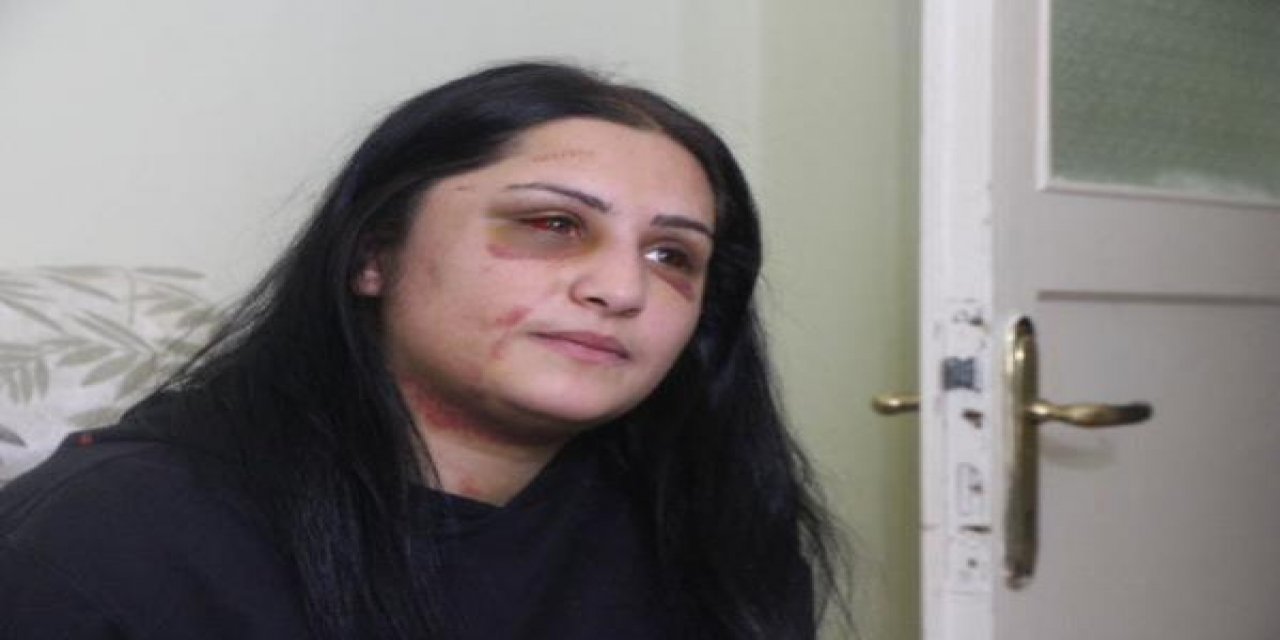Görüntüler Türkiye'yi ayağa kaldırmıştı... Samsun’da eski eşinin sokak ortasında dövdüğü kadın ilk kez konuştu! O anları anlattı...