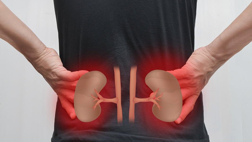 'Kovid- 19'a yakalanan böbrek hastalarında ölüm riski çok yüksek'