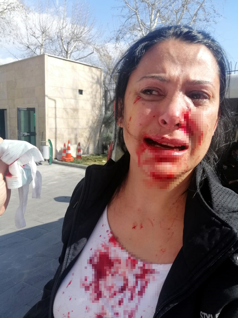 Öğretmen dehşet saçtı: Kalemi yüzüne sapladı