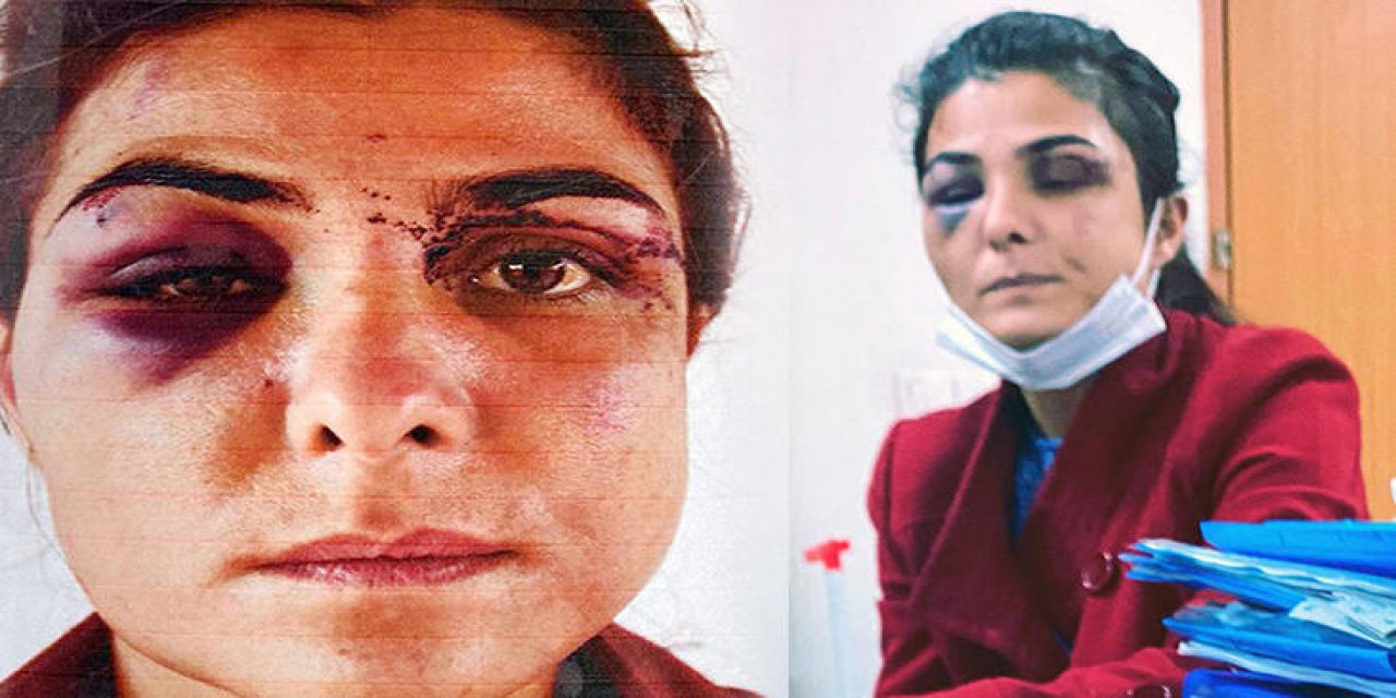 İşkenceci kocasını öldürmüştü... Melek İpek’in 112 görevlisiyle yaptığı konuşma ortaya çıktı! "Kocamı vurdum, çabuk yetişin"