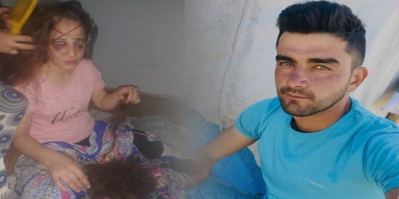 Eşine işkence yaptı, serbest kaldı: "Ne oldu tutuklatabildiniz mi?"