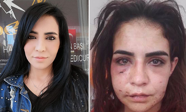 Tanınmaz hale gelen fotoğrafını paylaştı ve... Beyza'nın yardım çığlığı!