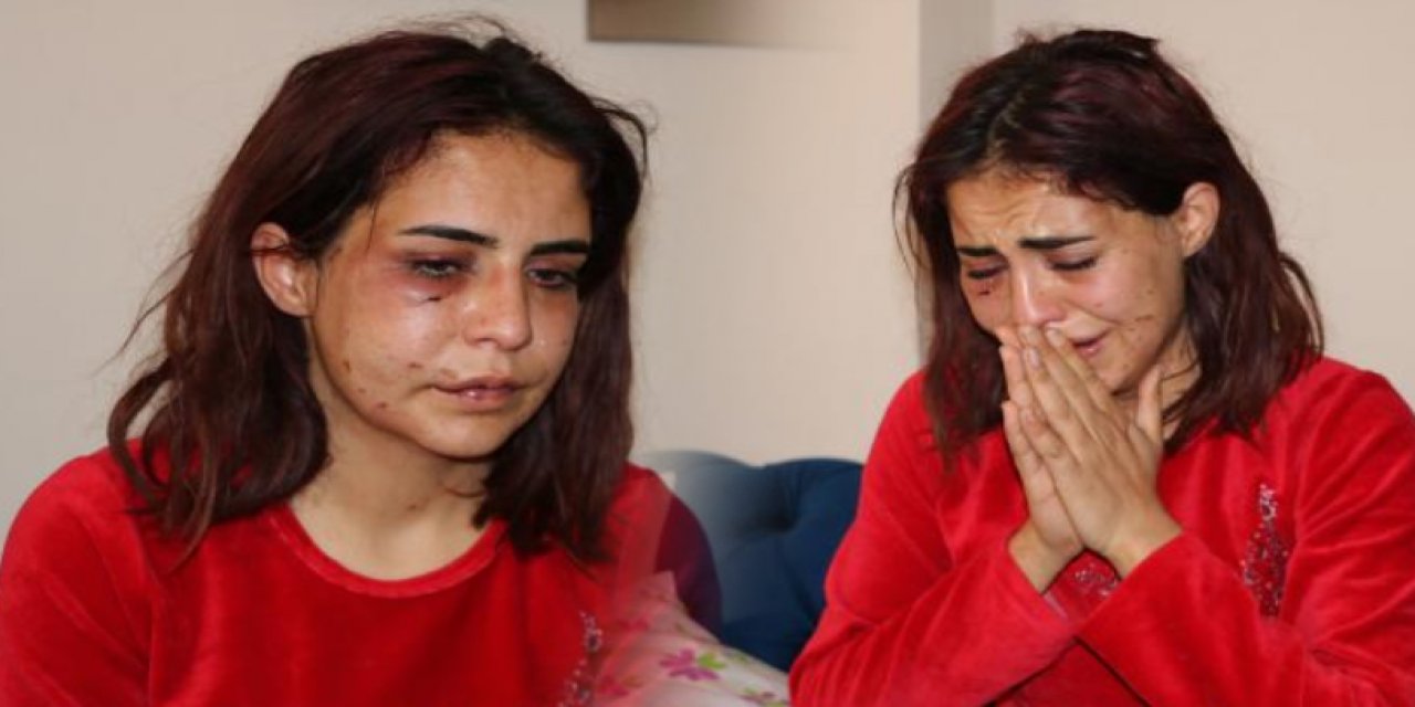 Sevgilisi tarafından öldüresiye dövülmüştü... Beyza dehşet anlarını anlattı: İmam nikahlı eşini arayıp "Nasıl olmuş aşkım?" demiş
