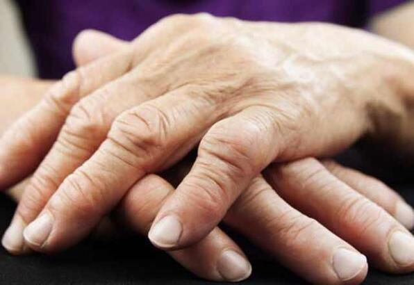 Uzman Dr. Fulya Dörtbaş'tan önemli 'eklem romatizması' açıklaması