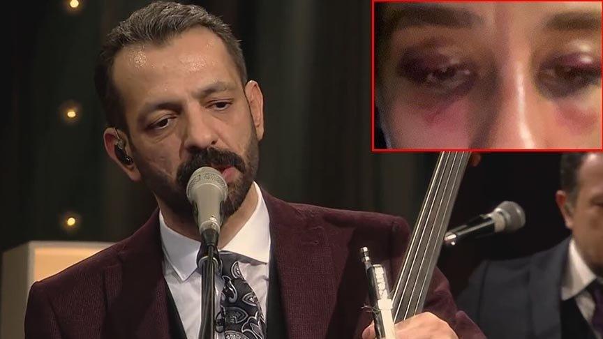 Şiddet... Cinsel saldırı... Rubato’nun solisti Özer Arkun’un davasında yeni gelişme
