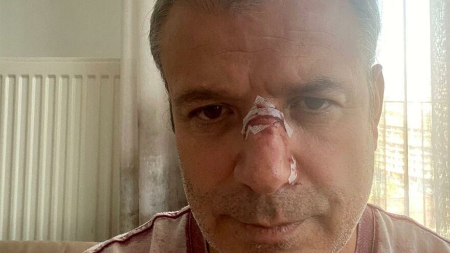 Manisa'da doktoru darp eden şahıstan skandal sözler! 'Sizi boşa dövmüyorlar'