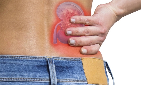 “Koronavirüs böbrek yetmezliğine neden olabilir”