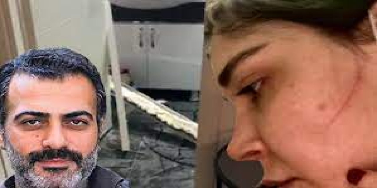 Sevgilisi Sevcan Yaşar’ı darbetmişti... Sermiyan Midyat’ın cezası belli oldu!