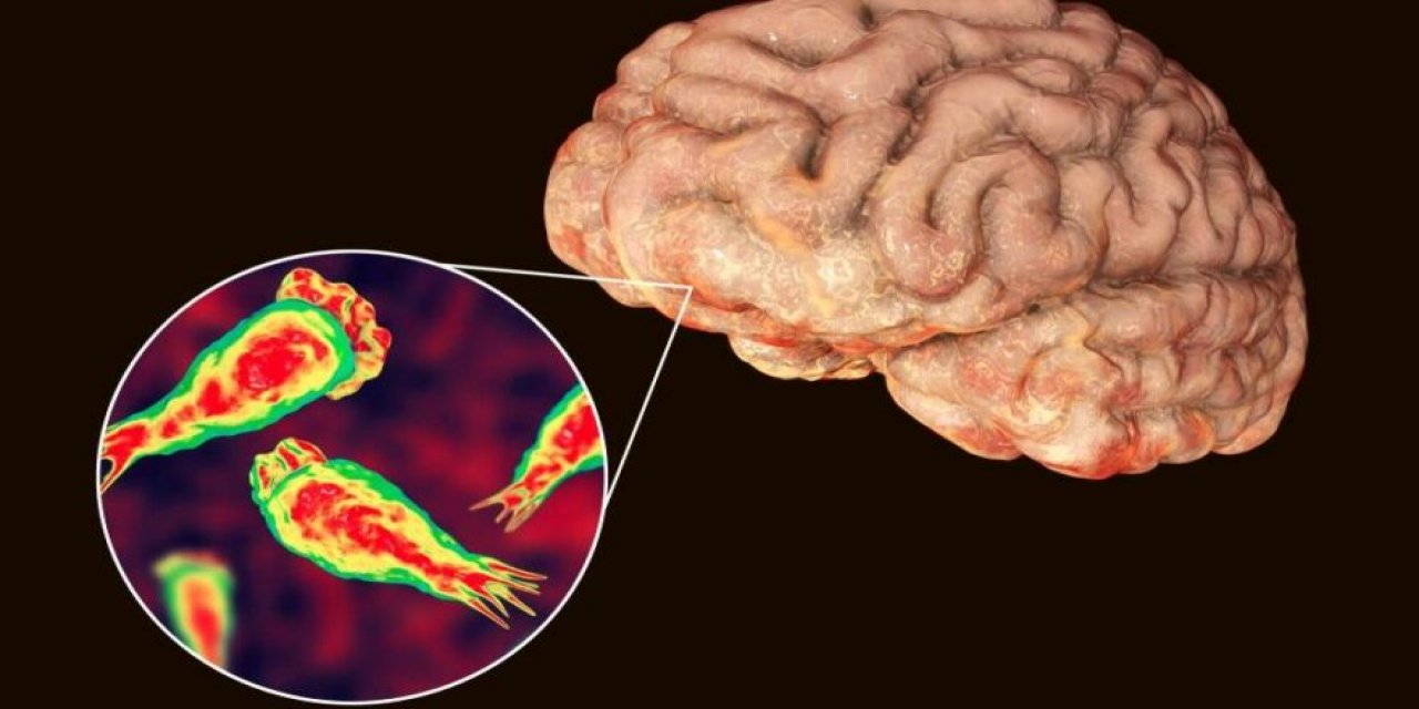 Baş ağrısı ile başlıyor, 3 günde öldürüyor... Beyin yiyen amip uyarısı!