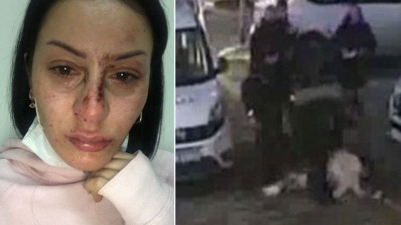 Görüntülere tepki yağmıştı... Polislerin darp ettiği kadına emniyet müdüründen çiçek
