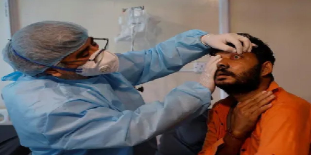 Tedavi olarak gözü çıkarıyorlar... Nedir bu "kara mantar"?